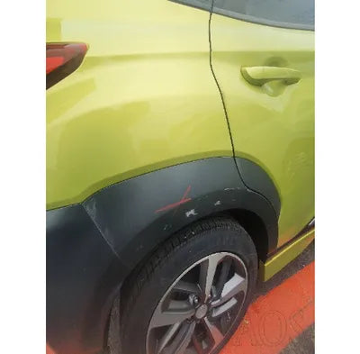 2018 Hyundai Kona KMHK4815GJU009395 VIN:KMHK4815GJU009395