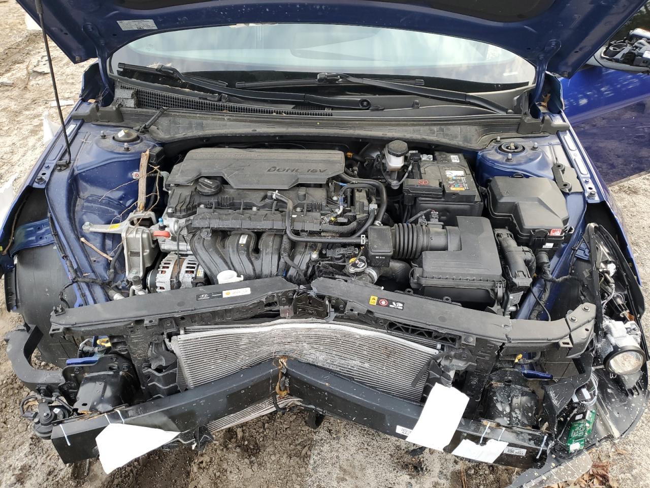 2022 HYUNDAI ELANTRA SEL VIN:KMHLS4AG7NU282904