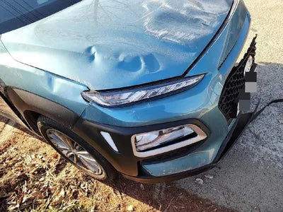 2017 Hyundai Kona VIN: