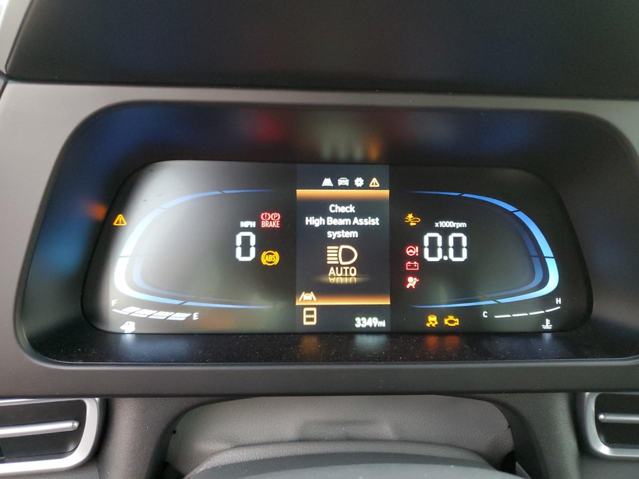 2024 HYUNDAI ELANTRA SE VIN:KMHLL4DG3RU817452