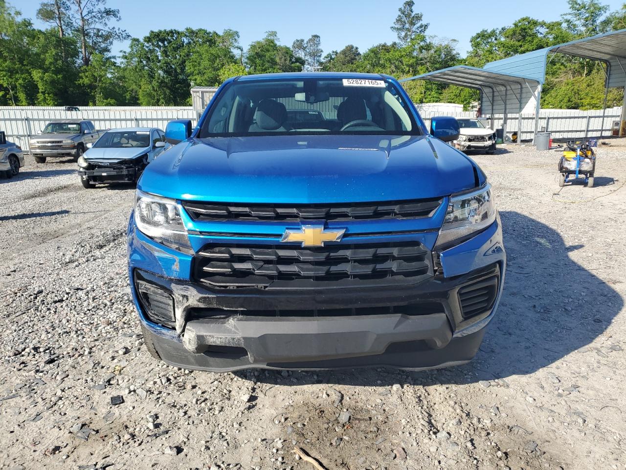 2022 CHEVROLET COLORADO  VIN:1GCGSBEN9N1108434