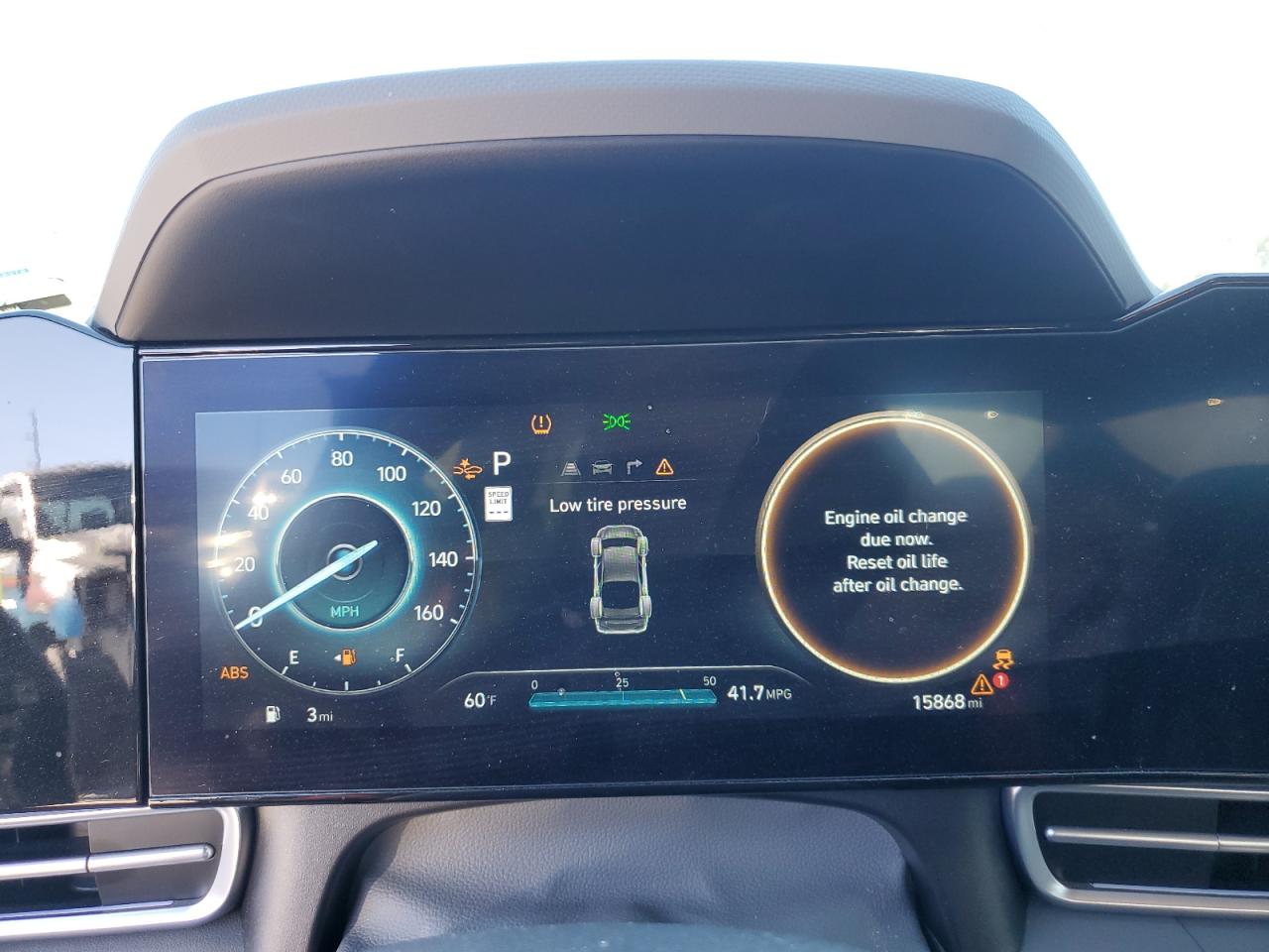 2024 HYUNDAI ELANTRA SEL VIN:KMHLM4DG5RU755176