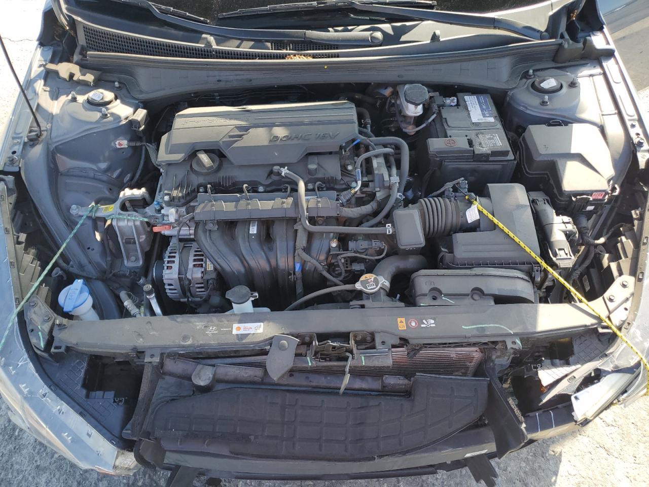 2022 HYUNDAI ELANTRA SEL VIN:KMHLM4AG5NU284449