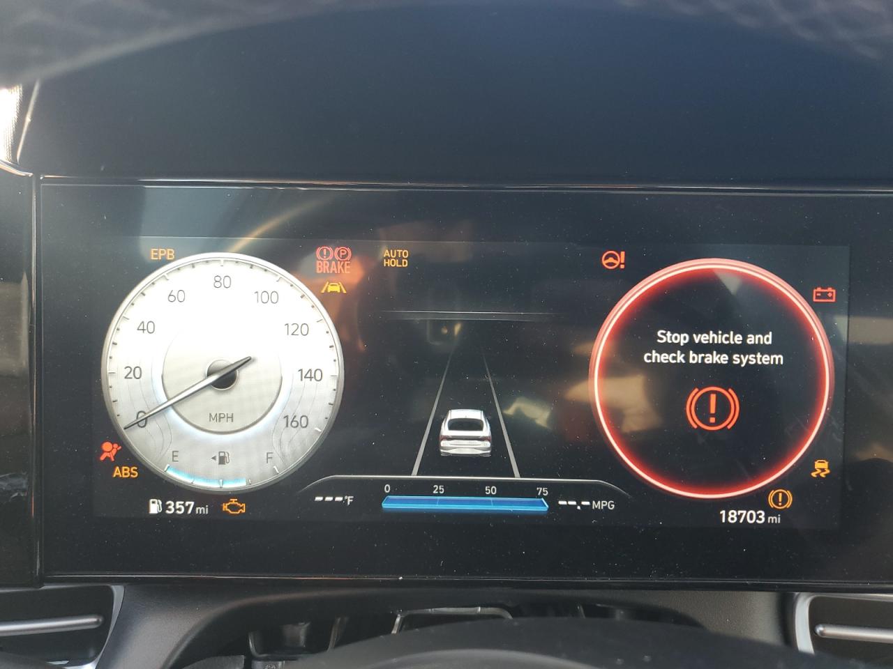 2023 HYUNDAI ELANTRA LIMITED VIN:KMHLN4AJ1PU075074