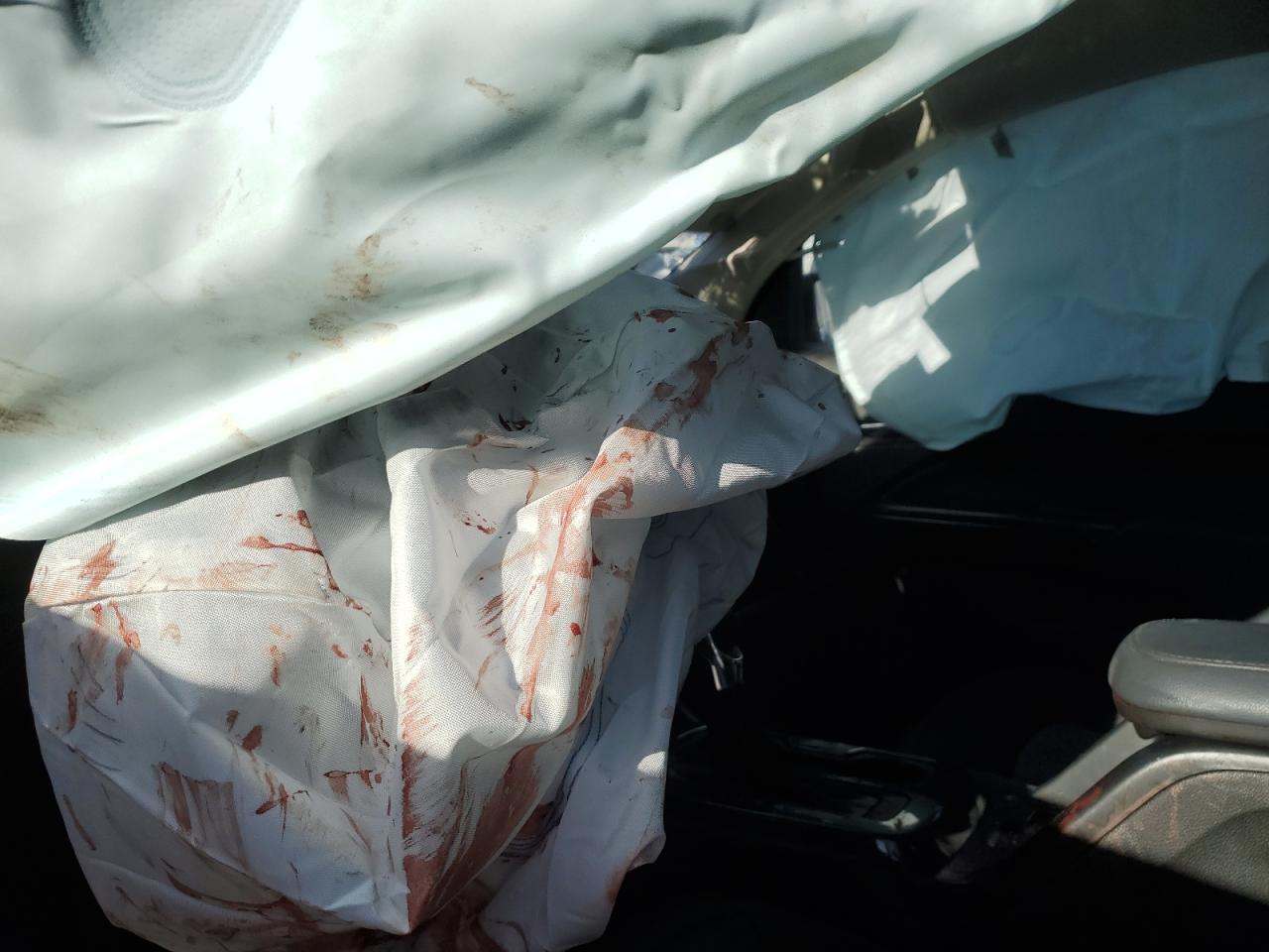 2022 CHEVROLET COLORADO Z71 VIN:1GCGTDEN7N1150951