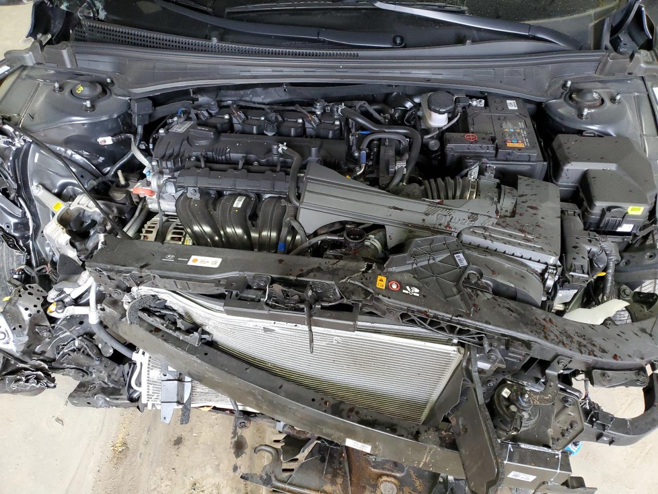 2024 HYUNDAI ELANTRA LIMITED VIN:KMHLP4DG5RU797760