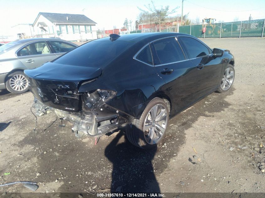 2021 ACURA TLX W/ADVANCE PACKAGE VIN: 19UUB6F65MA005271